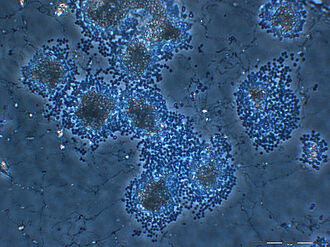 Sporenbaellchen des insektenpathogenen Pilzes Beauveria bassiana im Lichtmikroskop