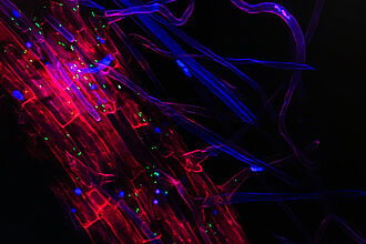 Wurzel können durch humane Pathogene (grün: Salmonella; rot: Zellwände; blau: Zellwände der Wurzelhaare) kolonisiert werden. Diese können durch kontaminiertes Gießwasser in den Boden und somit an die Wurzeloberfläche gelangen. © JKI