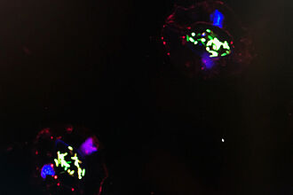 Überkopfbewässerung  bring das Risiko einer Kontamination der Blätter mit humanen Pathogenen (grün: Salmonella; rot: Chloroplasten; blau: Zellkern). An Blättern können diese in die Pflanze internalisieren, zB über die Stomata - wie hier gezeigt, somit sind sie (Pathogene) von negativen Umweltfaktoren aber auch vom Waschen geschützt. © JKI